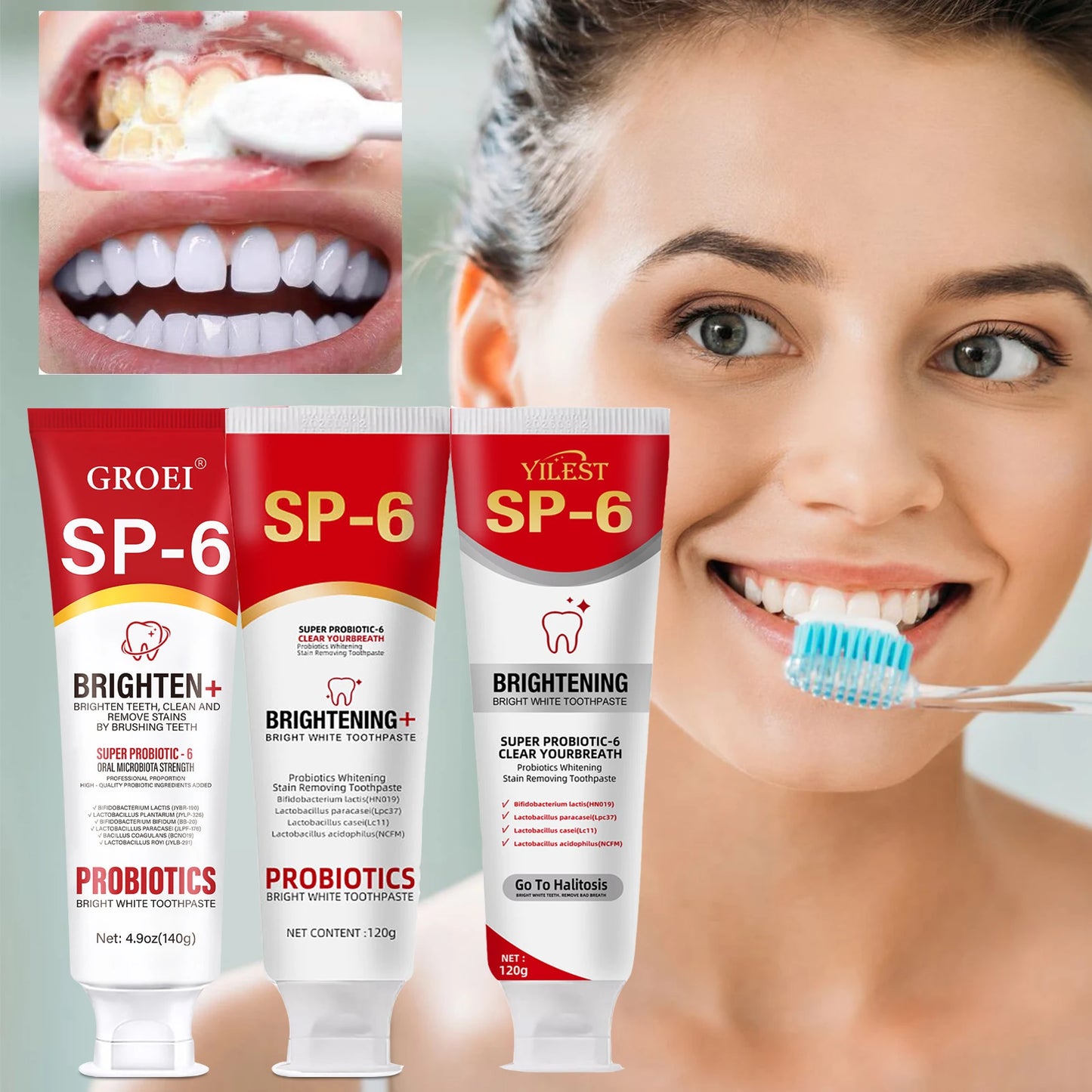 Dentifricio Probiotico SP-6: Sbiancante e Antimacchia