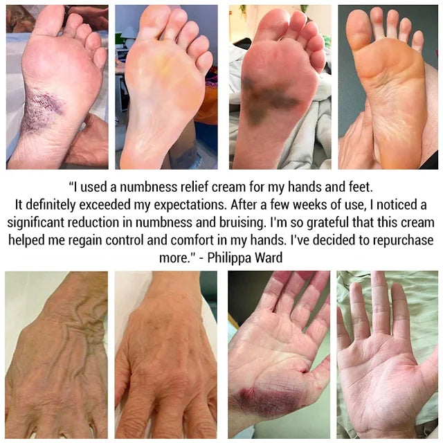 Neuro-pain relief cream