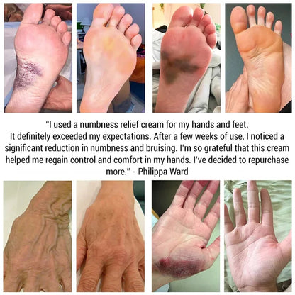 Neuro-pain relief cream