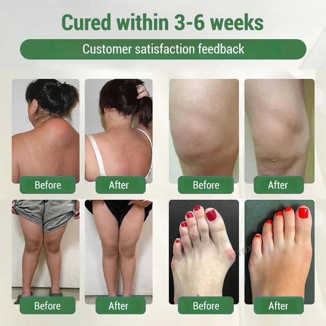 Neuro-pain relief cream