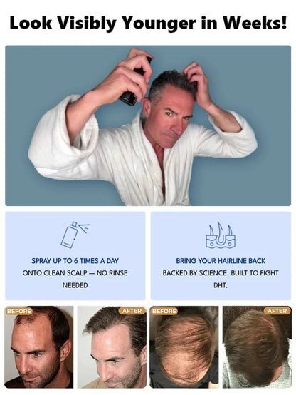 Hair Growth Essence Treatment Spray