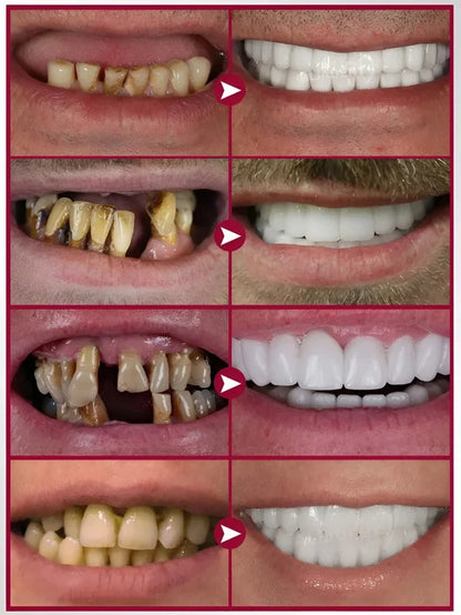 Oralhoe denture adhesive